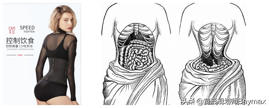 束腰真的能瘦身吗,束腰辟谣视频