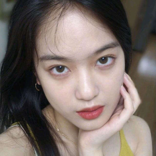 额头闭口和下巴闭口如何去除,下巴长闭口粉刺怎么去除小妙招