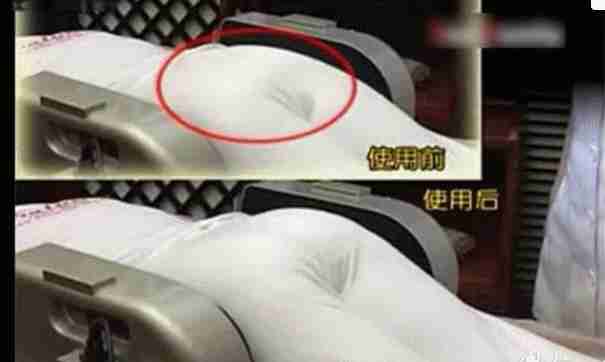 产后漏尿如何修复盆底肌,产后腰痛做盆底肌还是骨盆修复