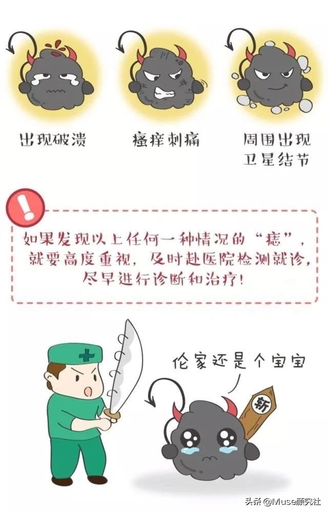 脸上长痦子是有福吗,脸上很容易长痣是什么原因