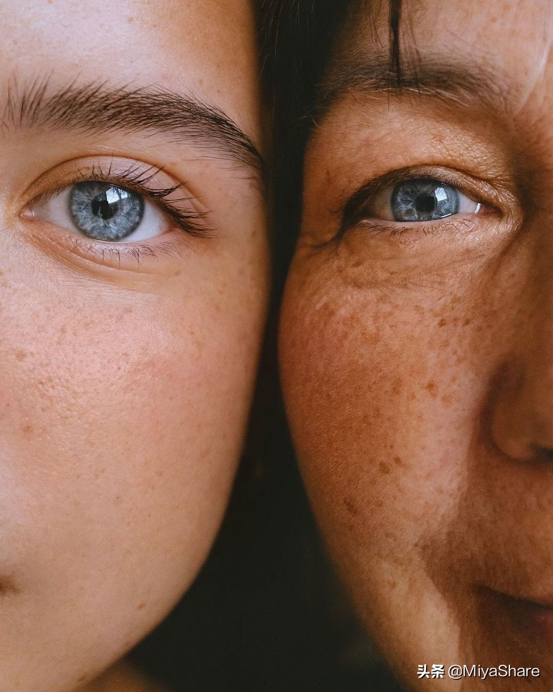 改善皮肤蜡黄暗沉的方法,皮肤暗沉发黄如何抗老