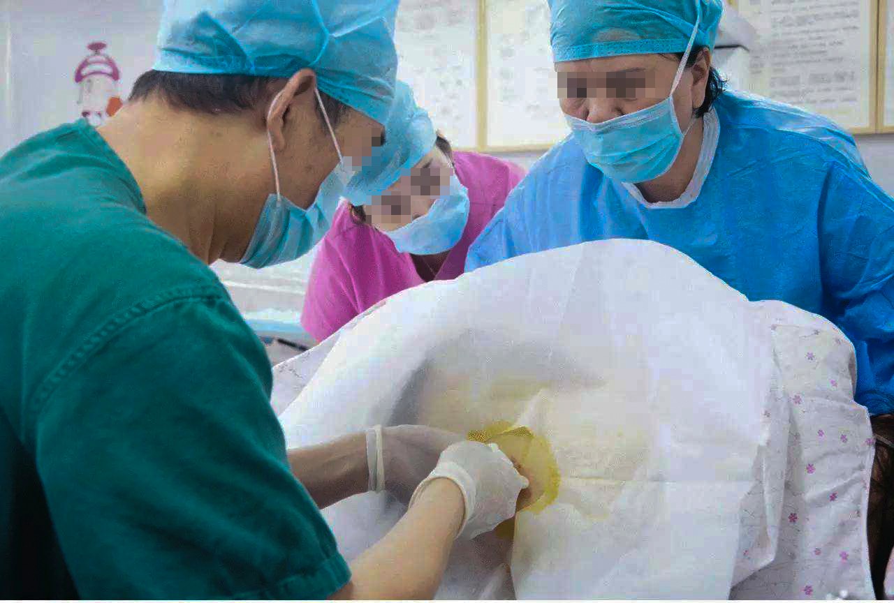 无痛分娩有禁忌症吗?