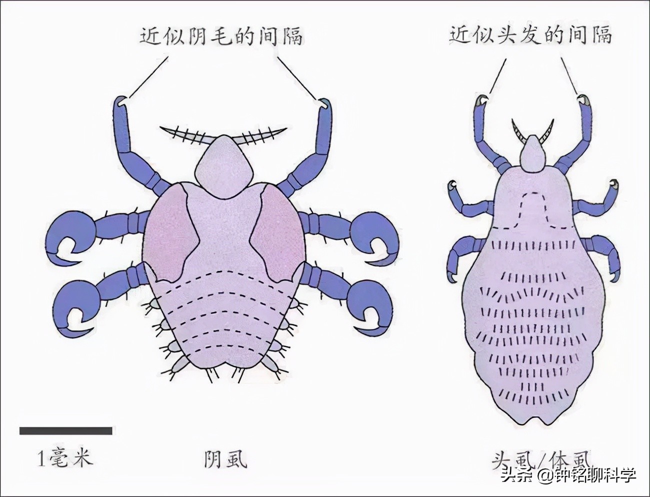 为什么虱子从21世纪就消失了,人类虱子的进化史