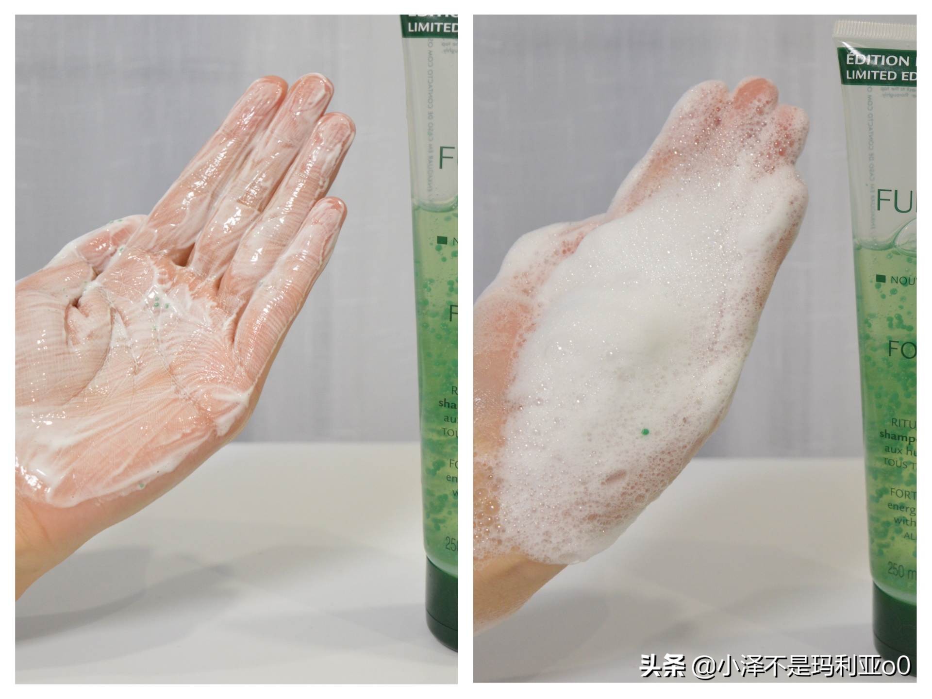 额头秃发际线后移适合什么洗发水,拯救发际线的洗发水