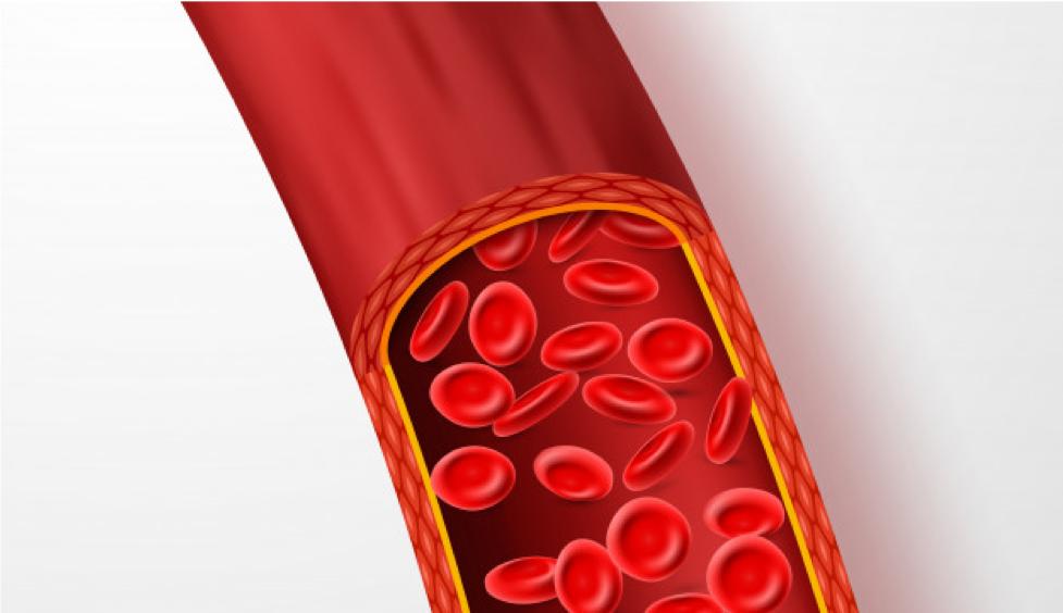 熊猫血怎么输血,熊猫血可以自体采血吗