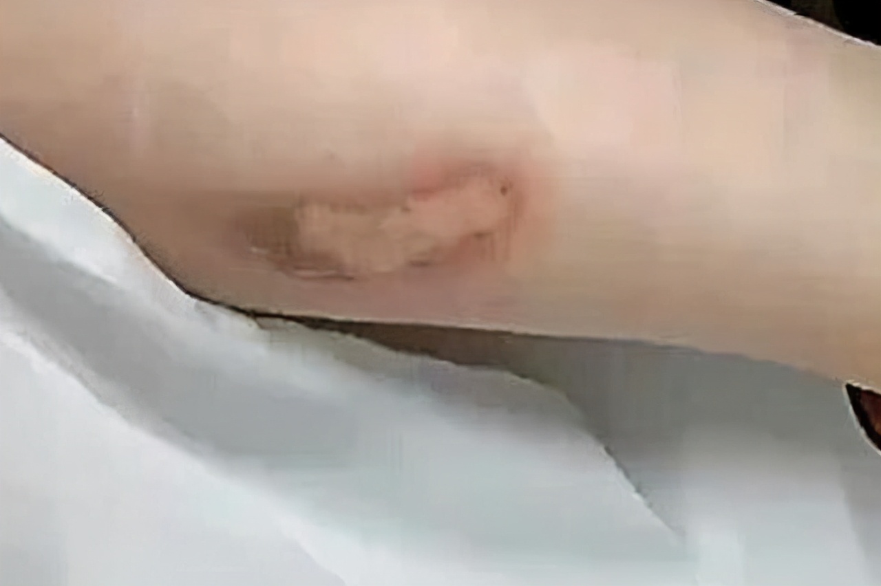 被奔驰大g烫过脚,女子坐奔驰大g下车