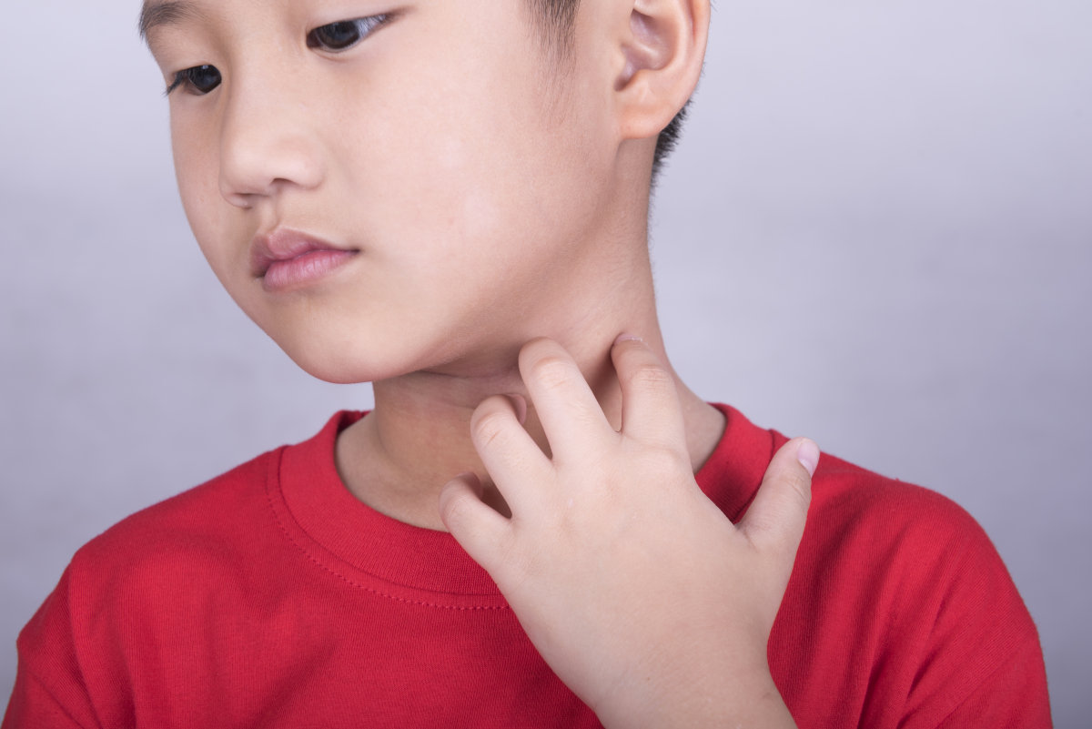 4岁儿童湿疹用什么药效果最好,4-5岁小孩湿疹怎么办最有效方法