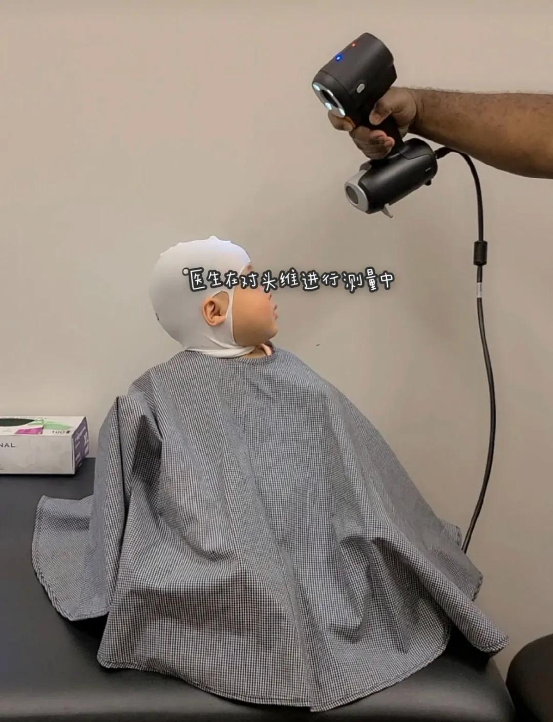 婴儿戴头盔矫正头型变畸形,婴儿戴摩托头盔