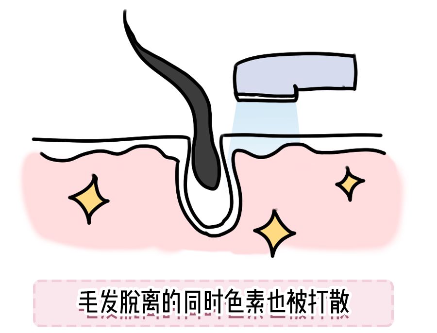 怕痛星人,怕痛选什么医美