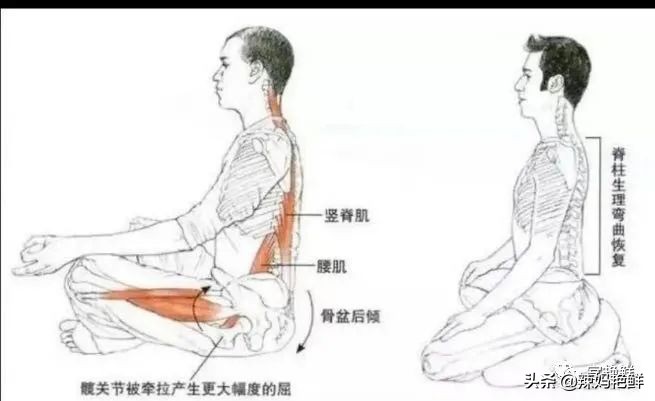 看起来驼背的几种情况,驼背后背中间驼怎么矫正