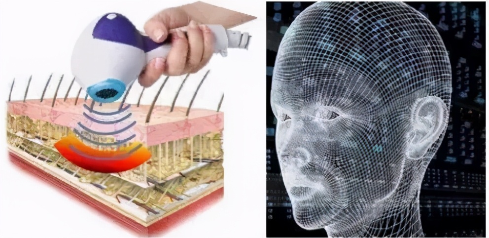 热拉提抗衰,抗衰老的杀手锏热拉提plus