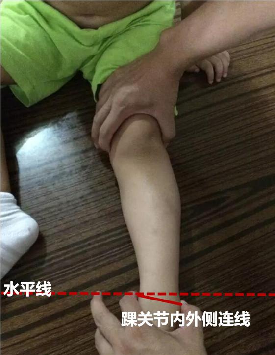 宝宝14个月走路o型腿怎么办,宝宝七个月腿不会扶走