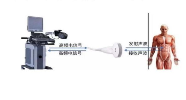 体检仪器大科普,健康体检b超