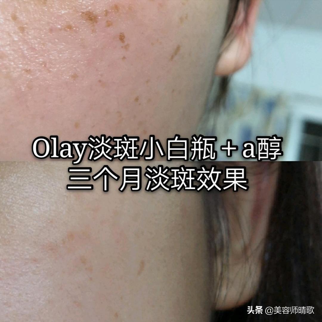 泰国卡尼尔美白精华可以变白吗,美白精华真实好用的