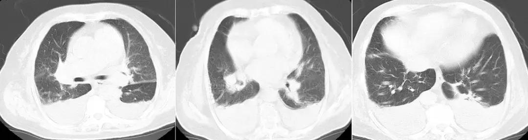 为什么说这个「古老」工具或许应重归呼吸医生的视野?