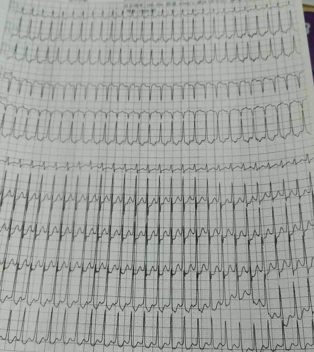 13岁男孩突然头晕脸白嘴唇发白,男孩突然大汗淋漓
