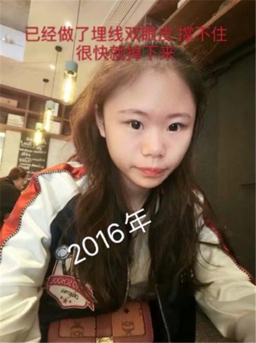 女子12次整容全部失败后的样子,女子整容12次全部失败之前的样貌