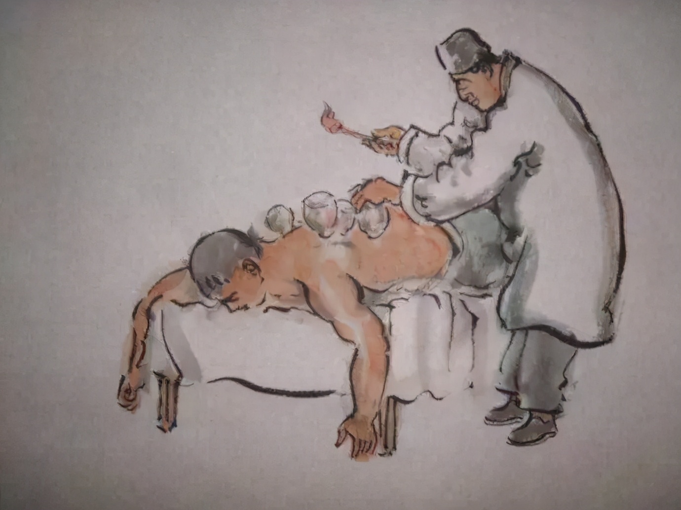 拔罐疗法的基本原理和常见的适应症,拔罐疗法的适用范围