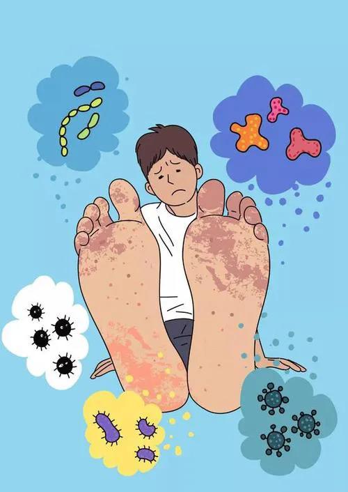 脚气奇痒又痛反复发作,脚气脚心痒痒难忍怎么办