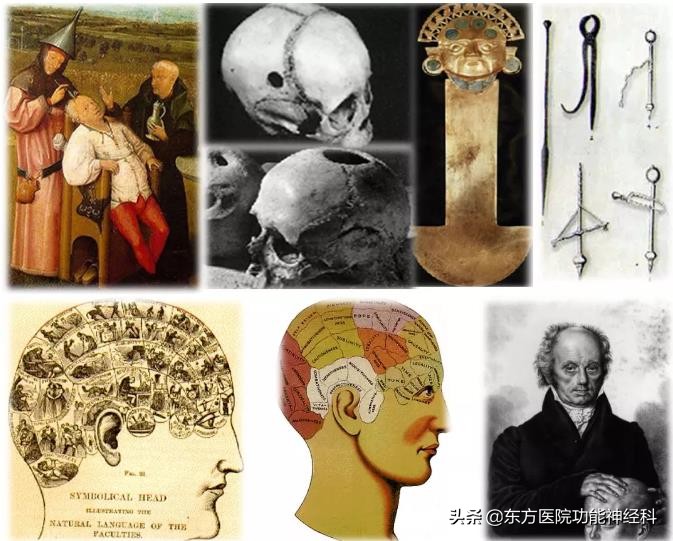 精神病人的前世,精神科药物的前世今生