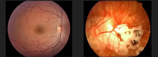 高度近视别人问你度数,别人问你近视多少度幽默回答