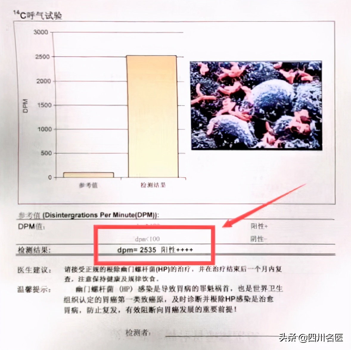严重口臭的原因及解决方法,口臭的真正原因解决方法