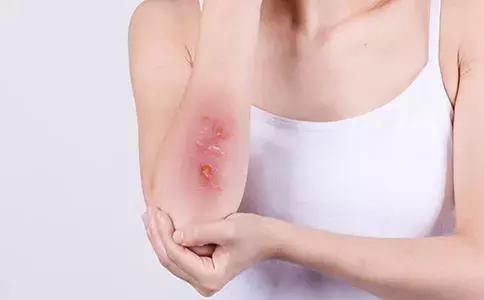 对轻伤和轻微伤的处罚,鼻骨骨折轻伤还是轻微伤判多久