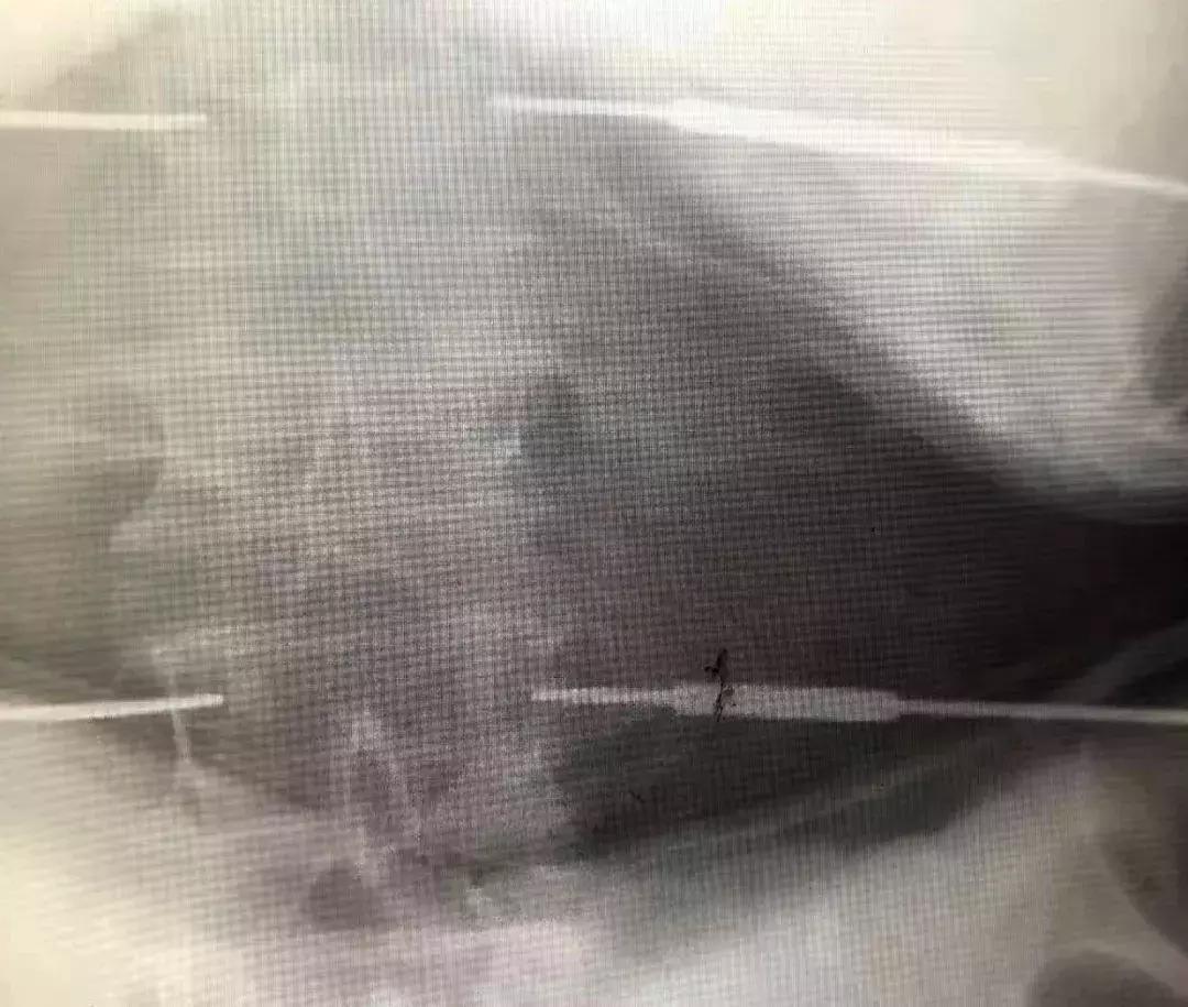 锦州发明专利,锦州实用新型专利