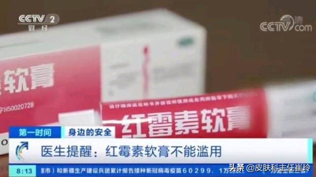 红霉素软膏长期用对皮肤有影响吗,紧急提醒这个常用药不能长期使用