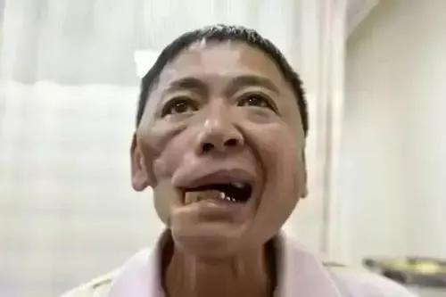 槟榔果实的危害,被称为恶魔果实的槟榔有多可怕