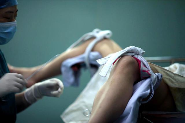 打过胎的女人害怕二次生育,打过胎的女性会有痕迹吗