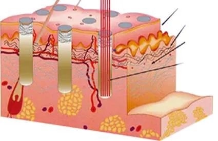眼睛周围长特别痒小疙瘩怎么回事,女性眼睛周围长疙瘩是什么原因