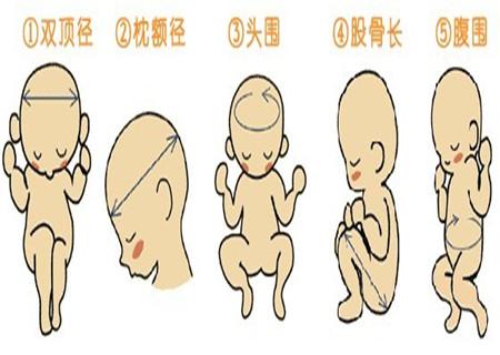 孕期B超检查单怎么看，帮你解惑B超问题