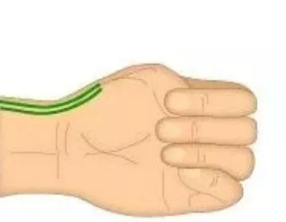 手麻要警惕左手麻木,手臂酸胀手指发麻警惕四种病