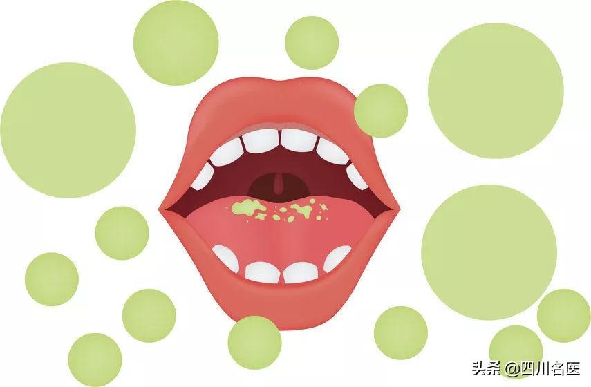 起床刷牙口苦,早上口苦刷牙后就好了什么原因