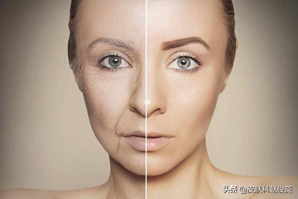 想要皮肤年轻吃什么,想要皮肤好胶原蛋白不能少