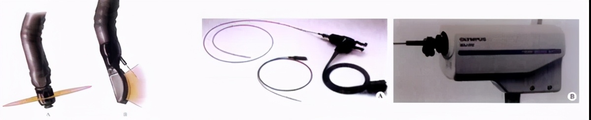 内镜超声引导下的肿瘤治疗例子,超声肿瘤筛查