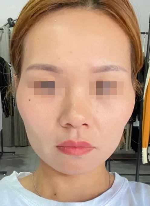 不对称脸型怎么改善,如何改善大小脸型