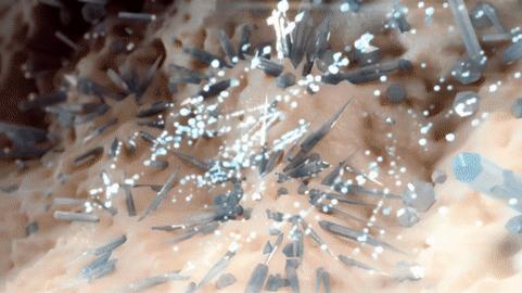 痛风患者哪些豆类不能吃,我国超千万人患痛风祸根