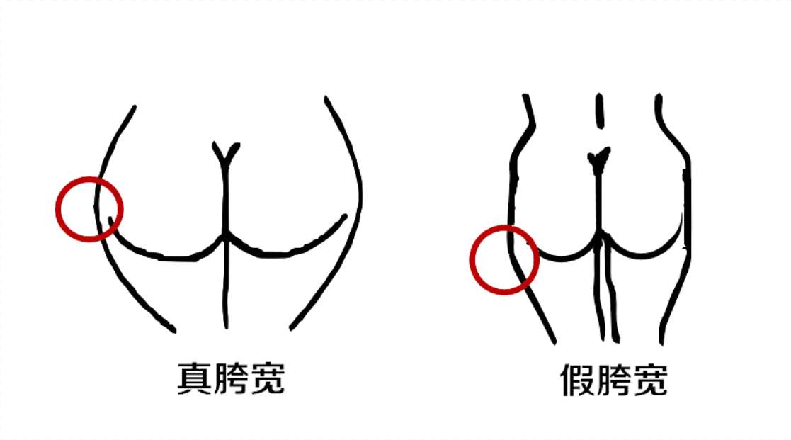 臀腿塑形5个动作拥有迷人臀腿,臀型怎么变假胯宽