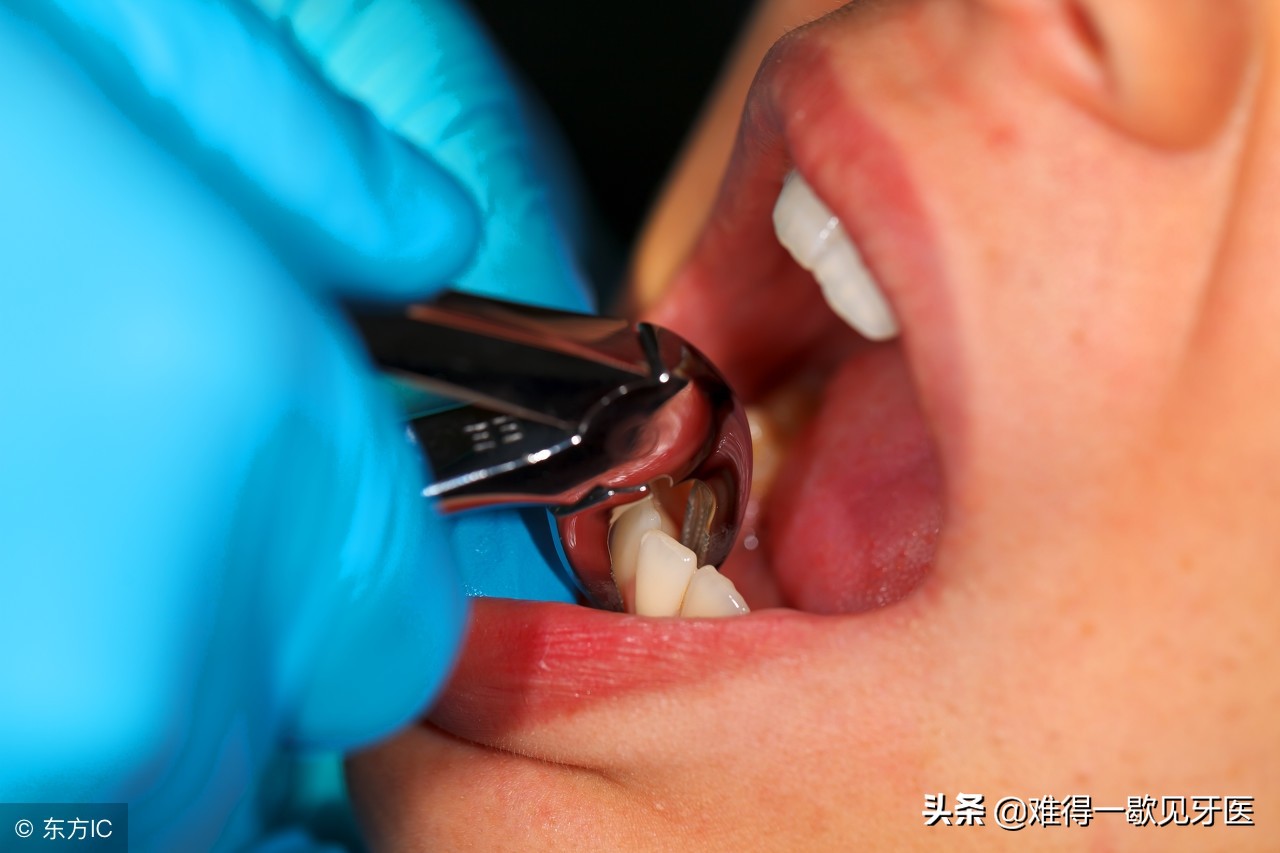 拔牙后如何减少麻药的副作用,矫正拔牙后的洞愈合过程