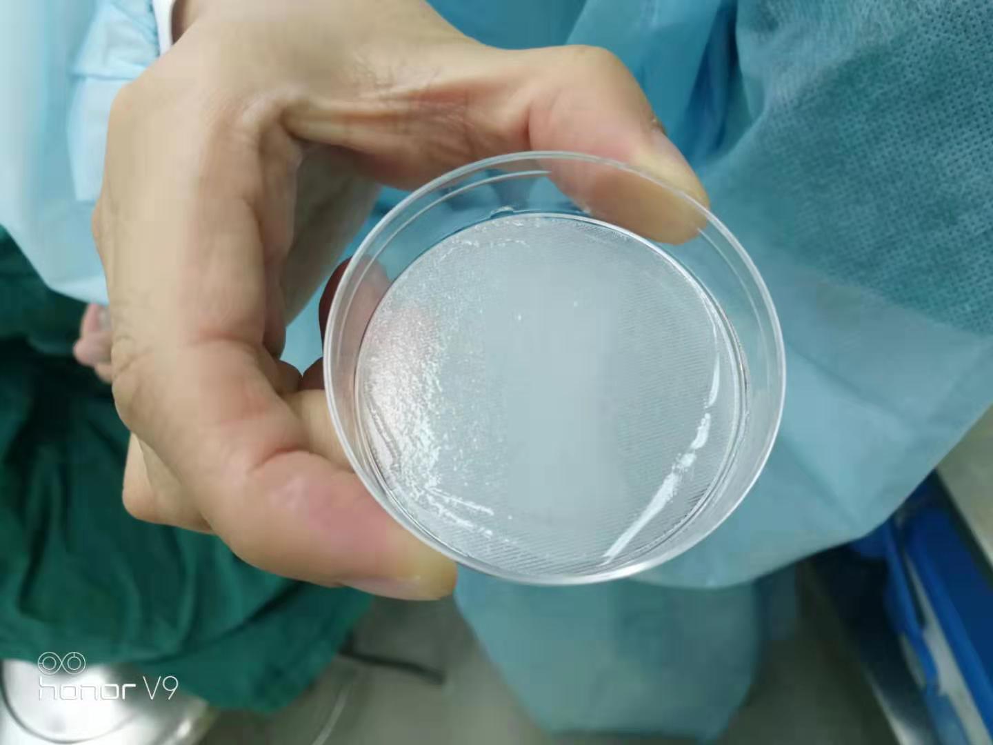 医生诊断白癜风打个问号,医生得了白癜风怎么办