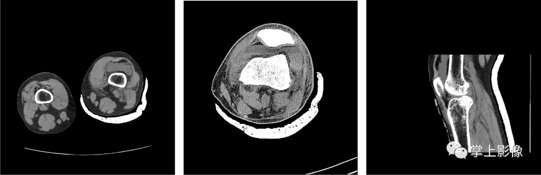 一种很少人知道的疾病,有哪些关节疾病
