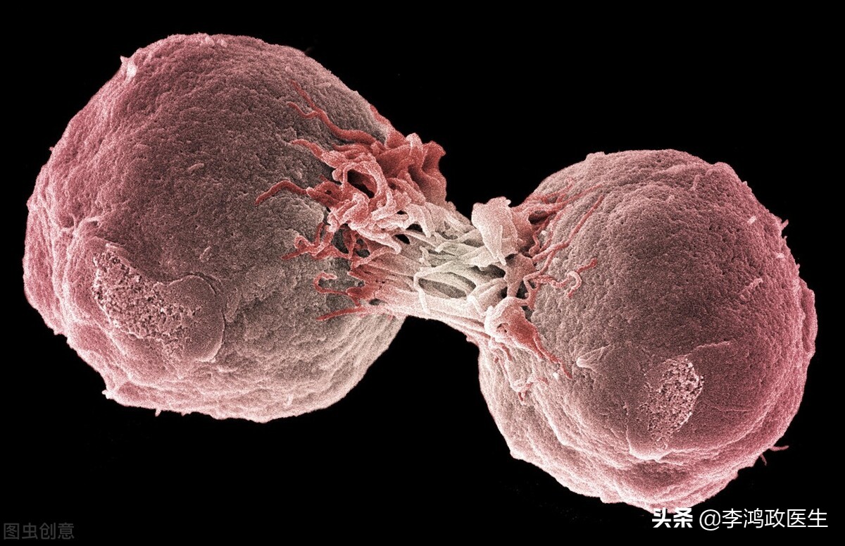 男子怪病脖子穿孔吃啥漏啥，神医还来骗钱，最终找我：被误诊25年
