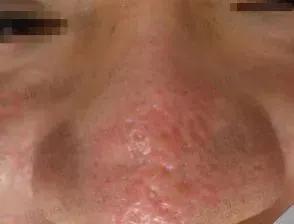 昕芙丽昕雅莎护肤品,昕芙丽和昕雅莎