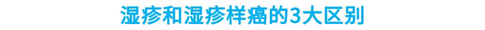 湿疹是癌症的前兆吗,湿疹变银屑病