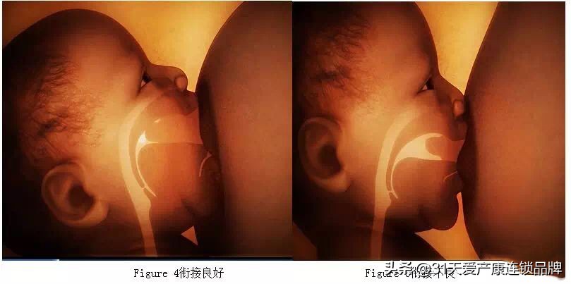 新手妈妈：史上最全乳房护理攻略