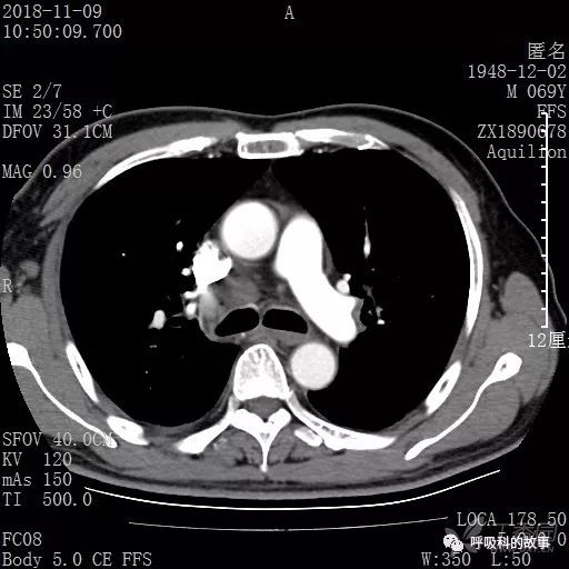 怎么应用统计学做调查,统计学方法可以解决的主要问题
