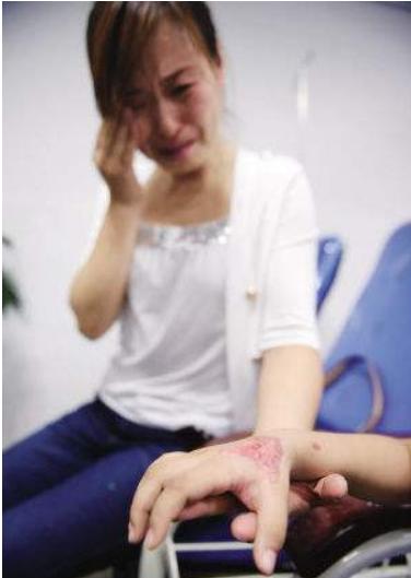 宝宝被门夹擦什么快好,婴儿被门夹伤该怎么办