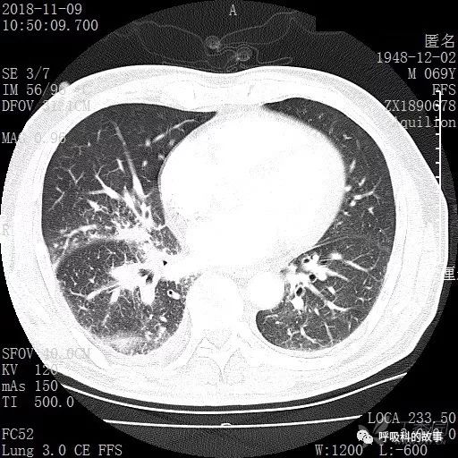 怎么应用统计学做调查,统计学方法可以解决的主要问题
